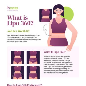 What Is Lipo 360 and Is It Worth It?